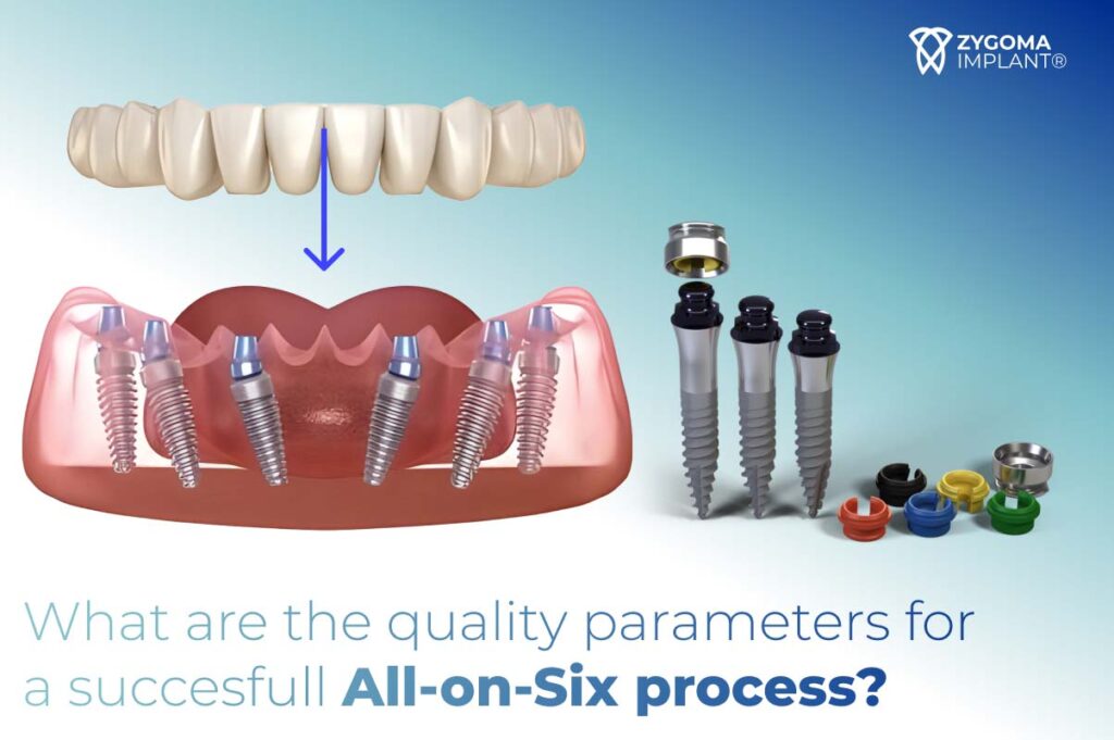 What are the quality parameters for a succesfull all on 6 process?