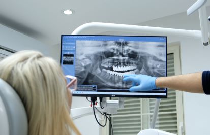 Dental Implants All-on-6